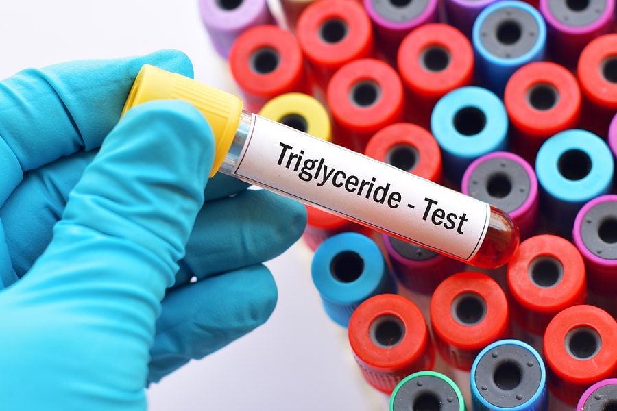 Serum Triglyceride